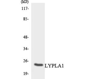 Western Blot - Anti-LYPLA1 Antibody (R12-2981) - Antibodies.com