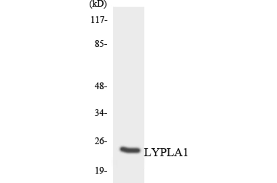 Western Blot - Anti-LYPLA1 Antibody (R12-2981) - Antibodies.com