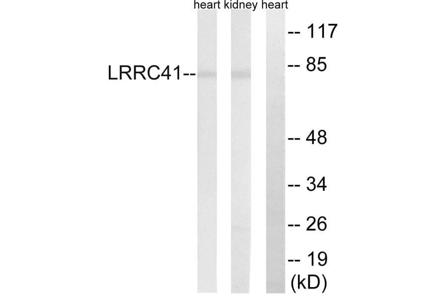 Western Blot - Anti-LRRC41 Antibody (C16455) - Antibodies.com