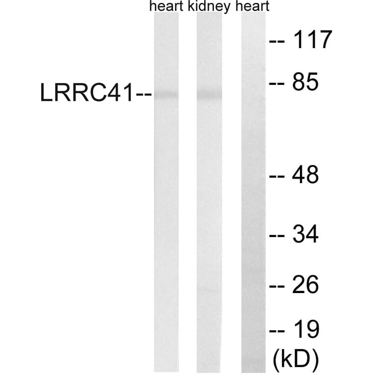 Western Blot - Anti-LRRC41 Antibody (C16455) - Antibodies.com