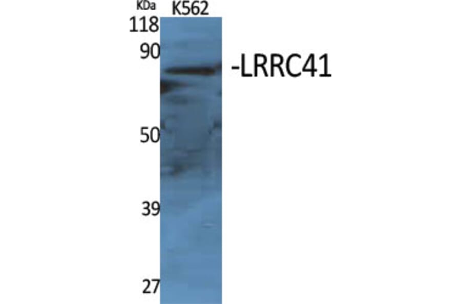 Western Blot - Anti-LRRC41 Antibody (C16455) - Antibodies.com