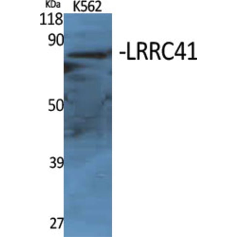 Western Blot - Anti-LRRC41 Antibody (C16455) - Antibodies.com