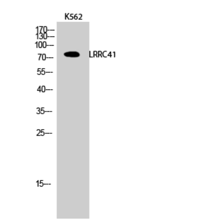 Western Blot - Anti-LRRC41 Antibody (C16455) - Antibodies.com