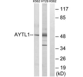 Western Blot - Anti-LPCAT2 Antibody (C14281) - Antibodies.com