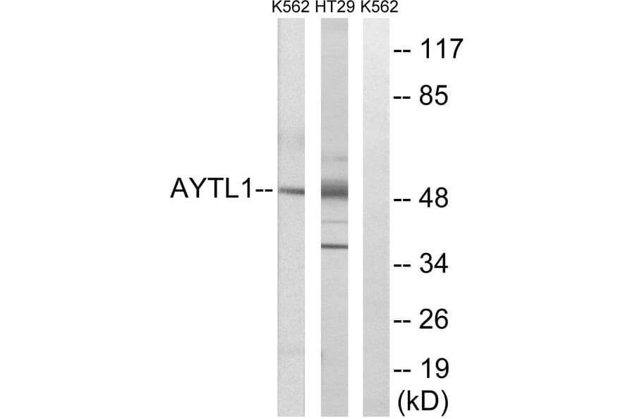 Western Blot - Anti-LPCAT2 Antibody (C14281) - Antibodies.com