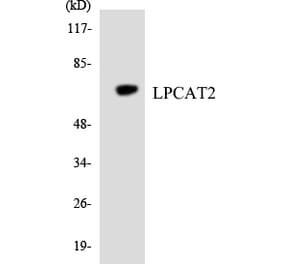 Western Blot - Anti-LPCAT2 Antibody (R12-2975) - Antibodies.com