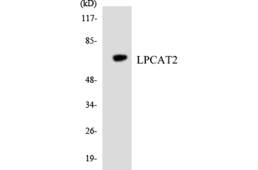 Western Blot - Anti-LPCAT2 Antibody (R12-2975) - Antibodies.com