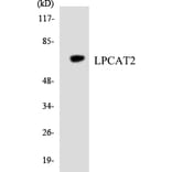 Western Blot - Anti-LPCAT2 Antibody (R12-2975) - Antibodies.com