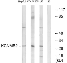 Western Blot - Anti-KCNMB2 Antibody (C14838) - Antibodies.com