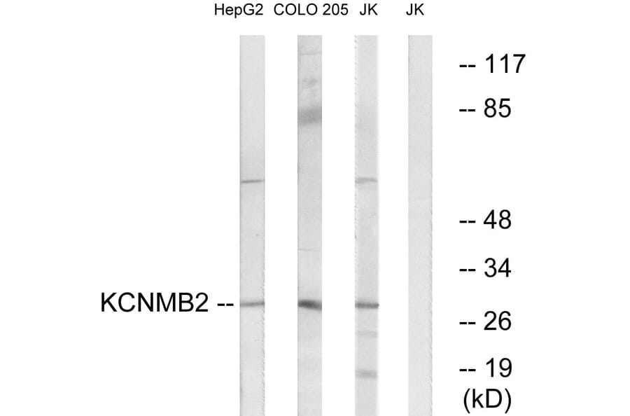 Western Blot - Anti-KCNMB2 Antibody (C14838) - Antibodies.com