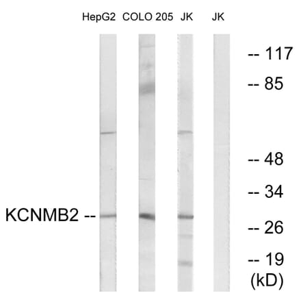 Western Blot - Anti-KCNMB2 Antibody (C14838) - Antibodies.com