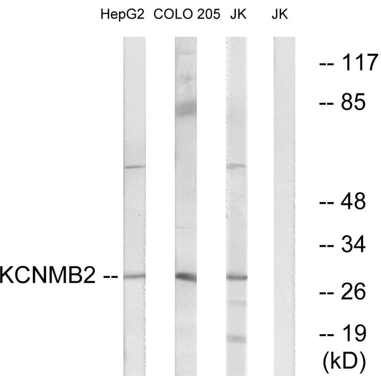 Western Blot - Anti-KCNMB2 Antibody (C14838) - Antibodies.com