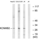 Western Blot - Anti-KCNMB2 Antibody (C14838) - Antibodies.com