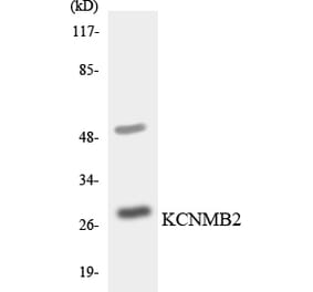 Western Blot - Anti-KCNMB2 Antibody (R12-2948) - Antibodies.com