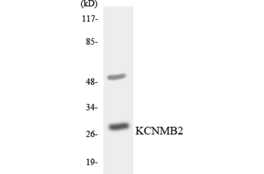 Western Blot - Anti-KCNMB2 Antibody (R12-2948) - Antibodies.com