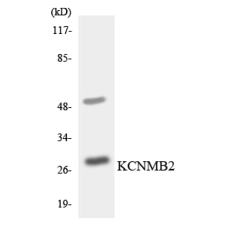 Western Blot - Anti-KCNMB2 Antibody (R12-2948) - Antibodies.com