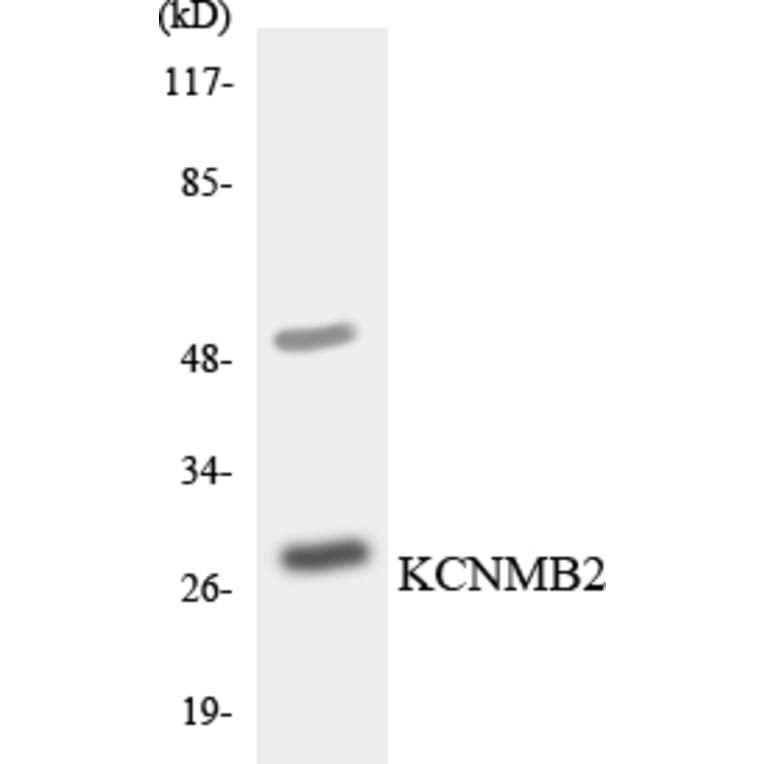 Western Blot - Anti-KCNMB2 Antibody (R12-2948) - Antibodies.com