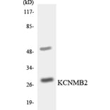 Western Blot - Anti-KCNMB2 Antibody (R12-2948) - Antibodies.com