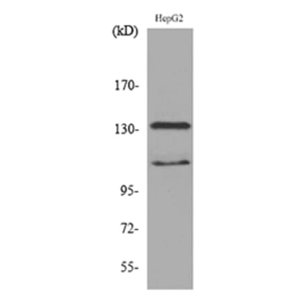 Western Blot - Anti-INPPL1 Antibody (C30278) - Antibodies.com