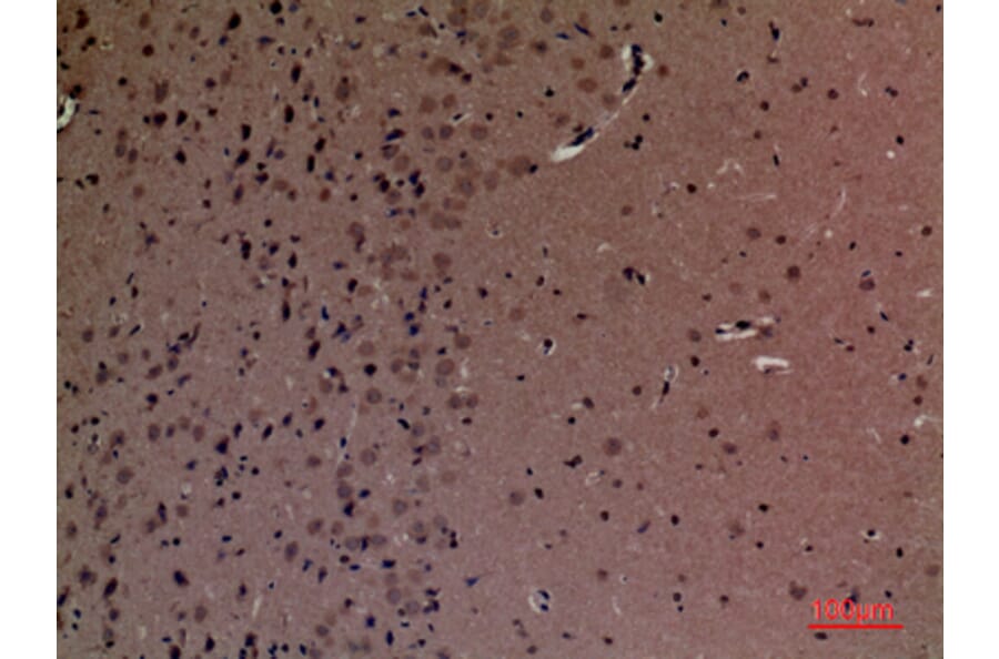 Immunohistochemistry - Anti-INPPL1 Antibody (C30278) - Antibodies.com