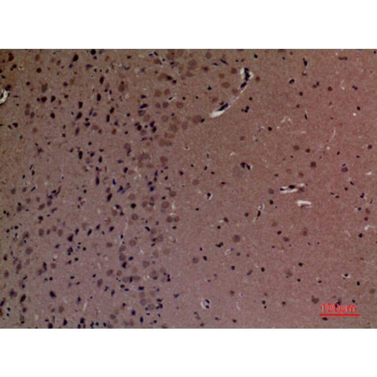 Immunohistochemistry - Anti-INPPL1 Antibody (C30278) - Antibodies.com