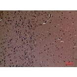 Immunohistochemistry - Anti-INPPL1 Antibody (C30278) - Antibodies.com