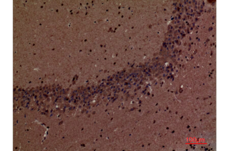 Immunohistochemistry - Anti-INPPL1 Antibody (C30278) - Antibodies.com