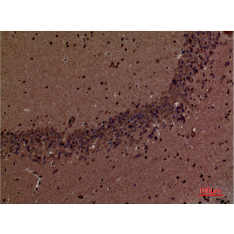 Immunohistochemistry - Anti-INPPL1 Antibody (C30278) - Antibodies.com