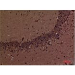 Immunohistochemistry - Anti-INPPL1 Antibody (C30278) - Antibodies.com