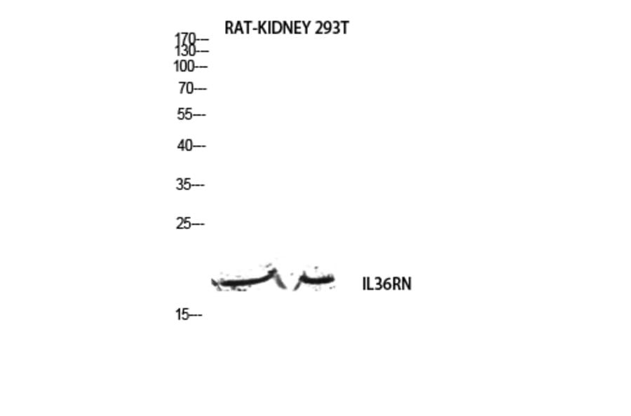 Western Blot - Anti-IL36RN Antibody (C30617) - Antibodies.com