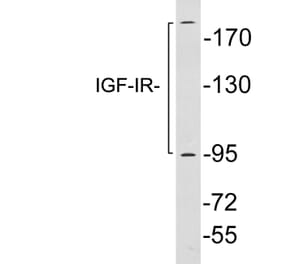 Western Blot - Anti-IGF-IR Antibody (R12-2196) - Antibodies.com