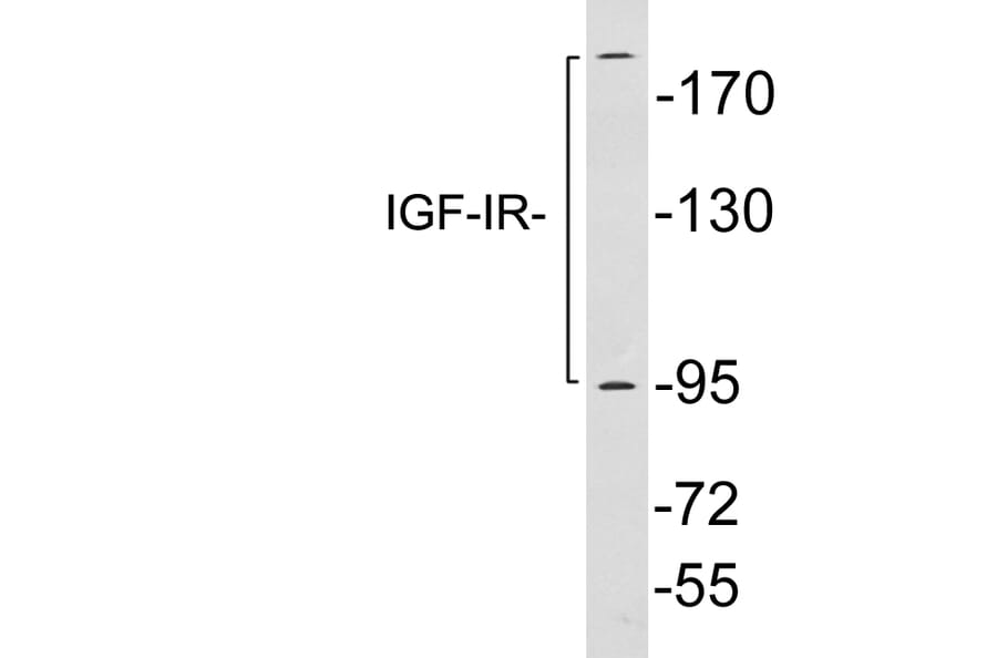 Western Blot - Anti-IGF-IR Antibody (R12-2196) - Antibodies.com