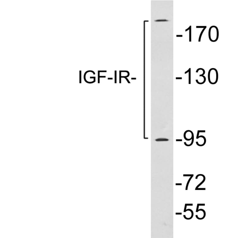 Western Blot - Anti-IGF-IR Antibody (R12-2196) - Antibodies.com