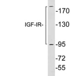 Western Blot - Anti-IGF-IR Antibody (R12-2196) - Antibodies.com