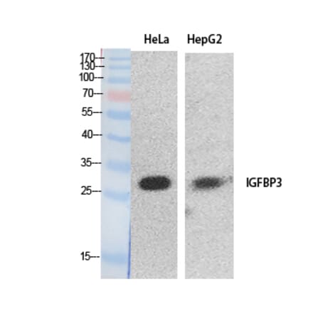 Western Blot - Anti-IGFBP3 Antibody (C30173) - Antibodies.com