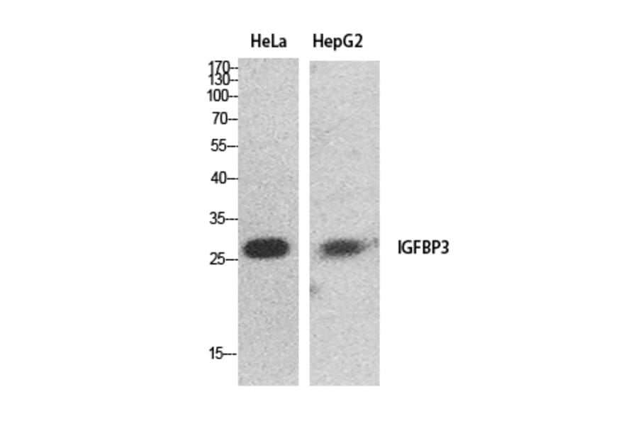 Western Blot - Anti-IGFBP3 Antibody (C30173) - Antibodies.com