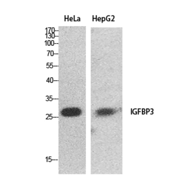 Western Blot - Anti-IGFBP3 Antibody (C30173) - Antibodies.com