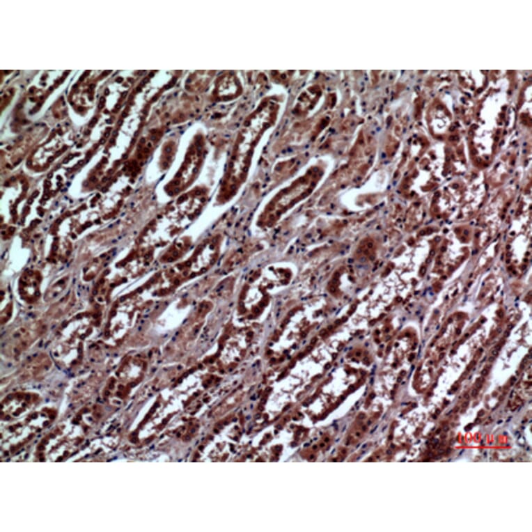 Immunohistochemistry - Anti-IGFBP3 Antibody (C30173) - Antibodies.com