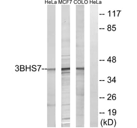 Western Blot - Anti-HSD3B7 Antibody (C14049) - Antibodies.com