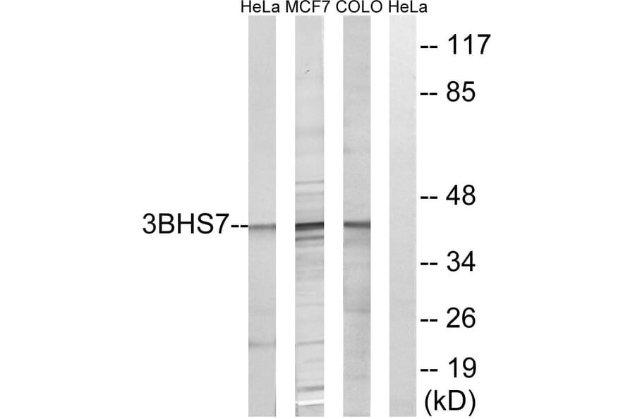 Western Blot - Anti-HSD3B7 Antibody (C14049) - Antibodies.com