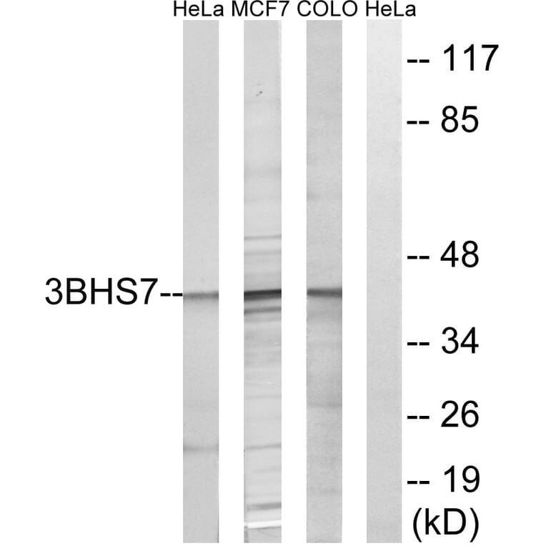 Western Blot - Anti-HSD3B7 Antibody (C14049) - Antibodies.com