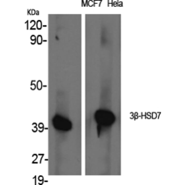 Western Blot - Anti-HSD3B7 Antibody (C14049) - Antibodies.com