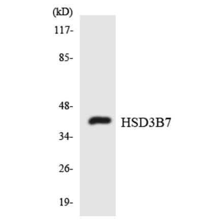 Western Blot - Anti-HSD3B7 Antibody (R12-2895) - Antibodies.com