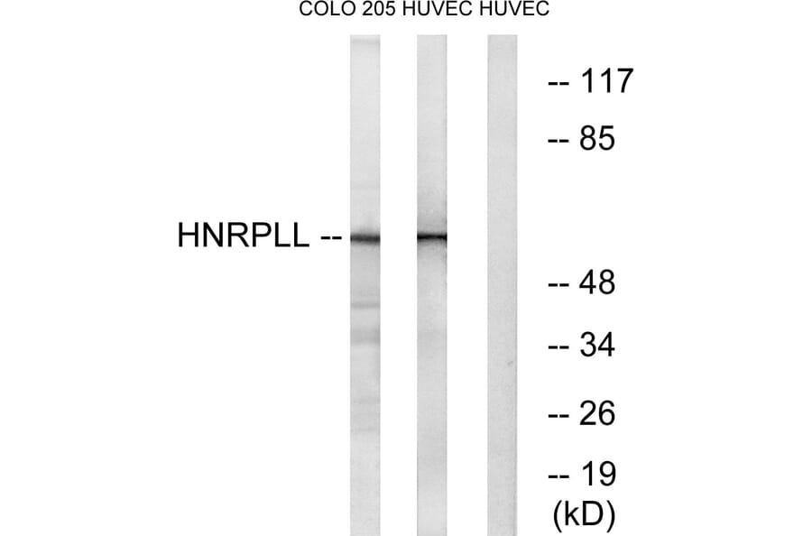 Western Blot - Anti-HNRPLL Antibody (C16119) - Antibodies.com