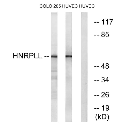 Western Blot - Anti-HNRPLL Antibody (C16119) - Antibodies.com