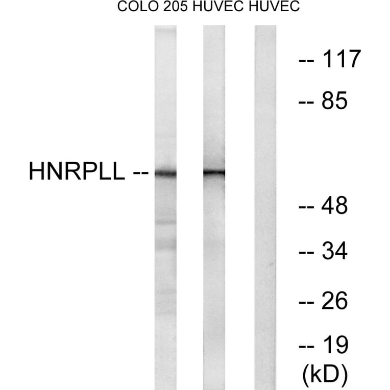 Western Blot - Anti-HNRPLL Antibody (C16119) - Antibodies.com