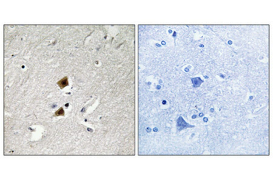 Immunohistochemistry - Anti-HNRPLL Antibody (C16119) - Antibodies.com