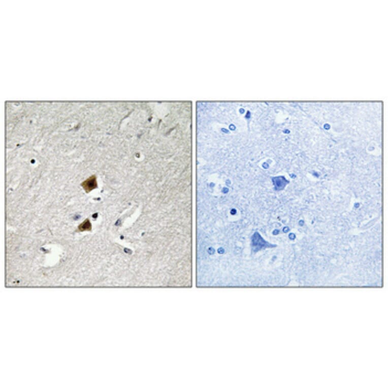 Immunohistochemistry - Anti-HNRPLL Antibody (C16119) - Antibodies.com