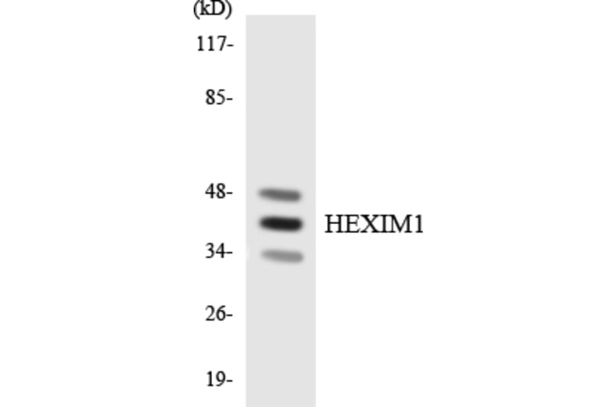 Western Blot - Anti-HEXIM1 Antibody (R12-2875) - Antibodies.com
