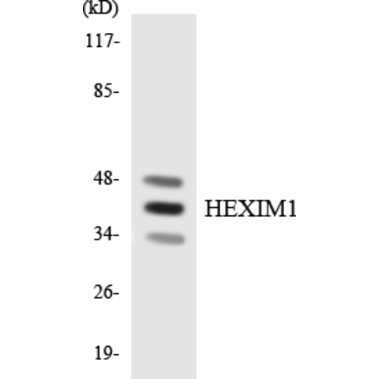 Western Blot - Anti-HEXIM1 Antibody (R12-2875) - Antibodies.com